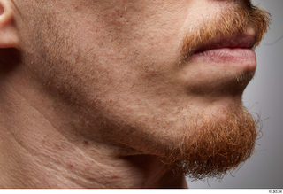 HD Face Skin John Hopkins chin face lips mouth skin…